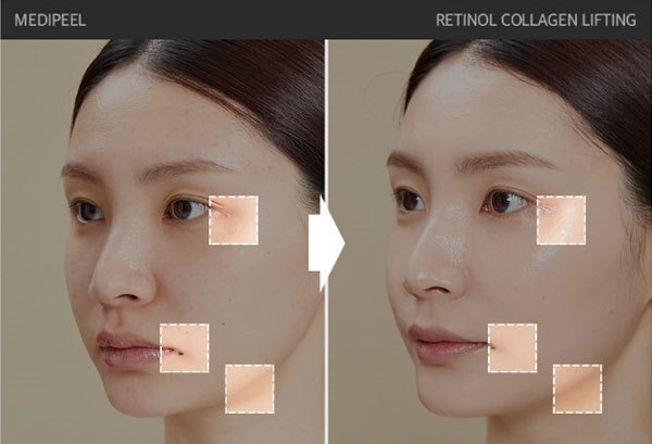 Medi-Peel Retinol Collagen Lifting Ampoule, 50 мл | MEDIPEEL